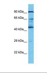 Western blot of Human MCF7. KRBA2 antibody dilution 1.0 ug/ml.
