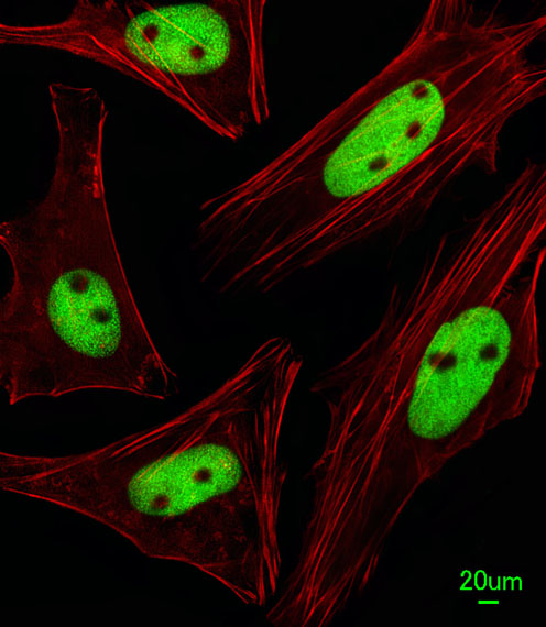Immunofluorescent of HeLa cells, using KRBA2 Antibody diluted 1:25. Alexa Fluor 488-conjugated goat anti-rabbit lgG at 1:400 dilution was used as the secondary antibody (green). Cytoplasmic actin was counterstained with Dylight Fluor 554 (red) conjugated Phalloidin (red).