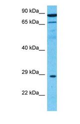 Western blot of KRCC1 Antibody with human Liver Tumor lysate.