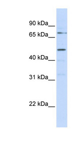 KREMEN1 antibody LS-C102149 Western blot of MCF7 cell lysate.