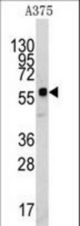 Western blot of anti-KREMEN1 Antibody in A375 cell line lysates (35 ug/lane). KREMEN1(arrow) was detected using the purified antibody.