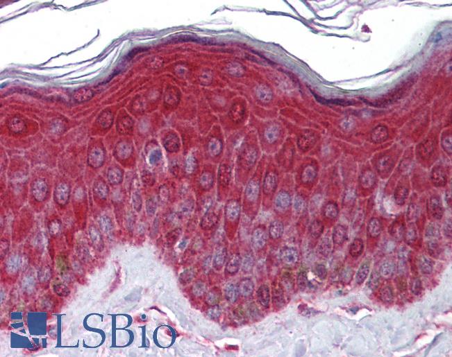 Anti-KREMEN1 antibody IHC of human skin. Immunohistochemistry of formalin-fixed, paraffin-embedded tissue after heat-induced antigen retrieval. Antibody LS-B5786 concentration 5 ug/ml.