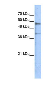 KREMEN1 antibody LS-B5786 Western blot of Transfected 293T cell lysate.