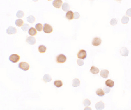 Immunocytochemistry of KREMEN2 in HeLa cells with KREMEN2 antibody at 5 ug/ml.
