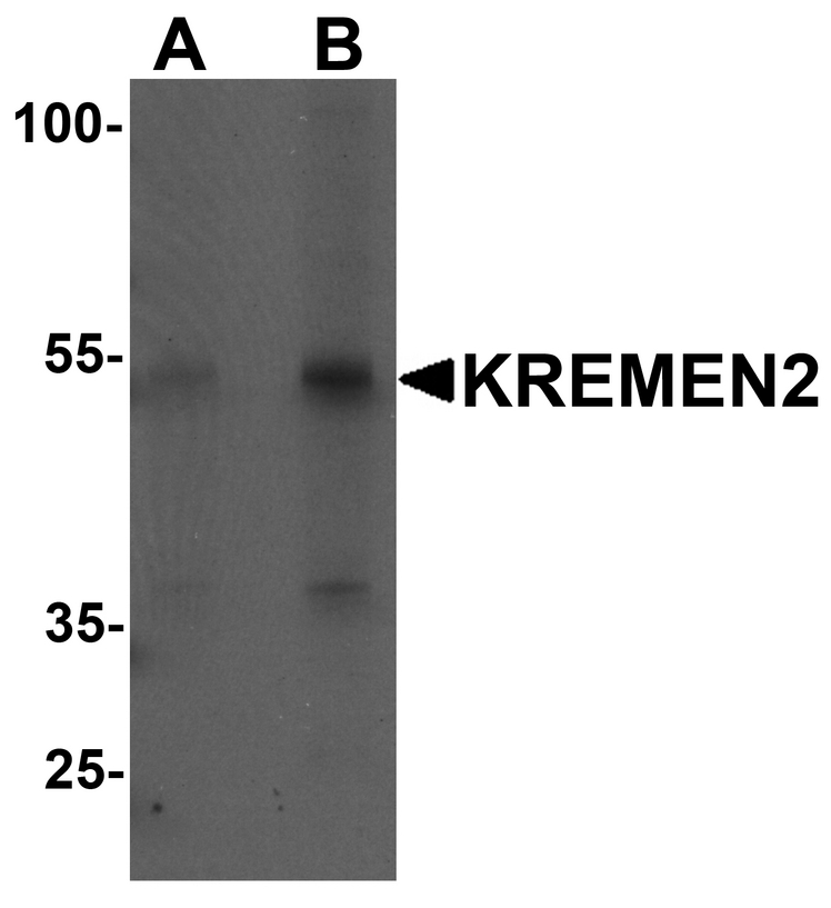 Western blot analysis of KREMEN2 in HeLa cell lysate with KREMEN2 antibody at (A) 1 and (B) 2 ug/ml.