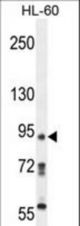 KRI1 Antibody western blot of HL-60 cell line lysates (35 ug/lane). The EKI2 antibody detected the EKI2 protein (arrow).