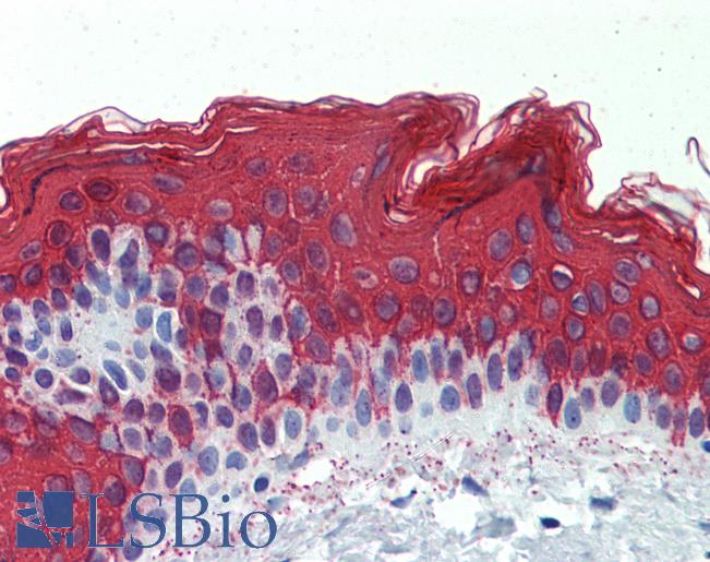 Anti-KRT1 / Cytokeratin 1 antibody IHC of human skin. Immunohistochemistry of formalin-fixed, paraffin-embedded tissue after heat-induced antigen retrieval. Antibody LS-B3989 concentration 2.5 ug/ml.