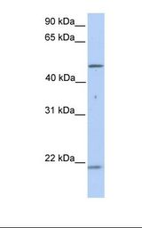 721_B cell lysate. Antibody concentration: 1.0 ug/ml. Gel concentration: 12%.