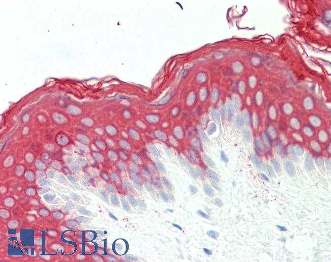 Anti-KRT10 / CK10 / Cytokeratin 10 antibody IHC staining of human skin. Immunohistochemistry of formalin-fixed, paraffin-embedded tissue after heat-induced antigen retrieval.