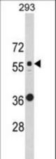 Western blot of KRT10 Antibody in 293 cell line lysates (35 ug/lane). KRT10 (arrow) was detected using the purified antibody.