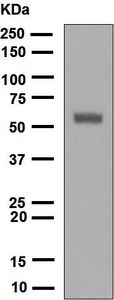 Western blot analysis on rat eyeball lysate using anti-Cytokeratin 12 antibody.