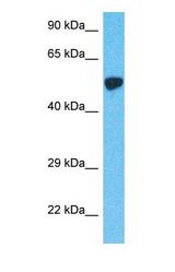 Western blot of KRT12 Antibody with human MCF7 Whole Cell lysate.