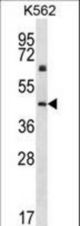 KRT12 Antibody western blot of K562 cell line lysates (35 ug/lane). The KRT12 antibody detected the KRT12 protein (arrow).