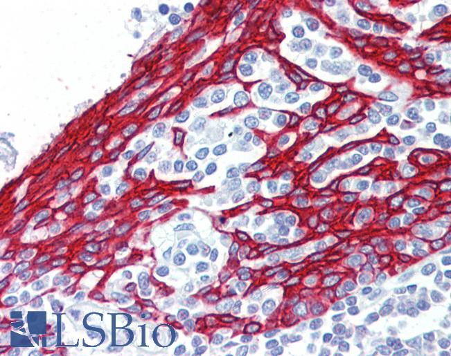 Anti-KRT13 / Cytokeratin 13 antibody IHC of human tonsil. Immunohistochemistry of formalin-fixed, paraffin-embedded tissue after heat-induced antigen retrieval. Antibody LS-B3608 concentration 2.5 ug/ml.