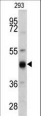 Western blot of KRT13 antibody in 293 cell line lysates (35 ug/lane). KRT13 (arrow) was detected using the purified antibody.