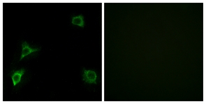 Immunofluorescence of HUVEC cells, using GRID2 Antibody. The picture on the right is treated with the synthesized peptide.