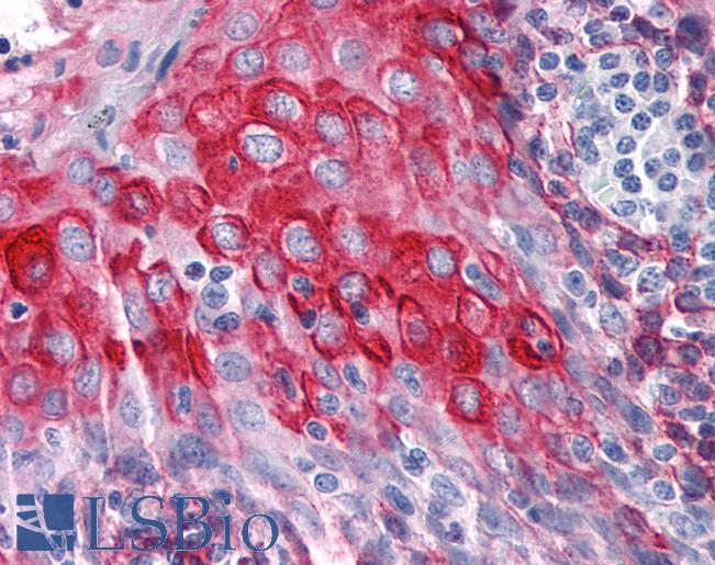 Anti-KRT15 / Cytokeratin 15 antibody IHC of human tonsil. Immunohistochemistry of formalin-fixed, paraffin-embedded tissue after heat-induced antigen retrieval. Antibody LS-B4120 dilution 1:200.