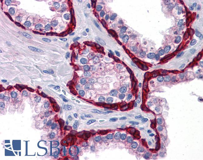 Anti-KRT15 / Cytokeratin 15 antibody IHC of human prostate. Immunohistochemistry of formalin-fixed, paraffin-embedded tissue after heat-induced antigen retrieval. Antibody LS-B4120 dilution 1:200.