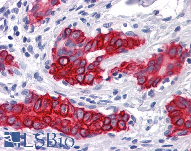 Anti-KRT15 / Cytokeratin 15 antibody IHC of human breast. Immunohistochemistry of formalin-fixed, paraffin-embedded tissue after heat-induced antigen retrieval. Antibody LS-B4120 dilution 1:200.