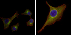 Immunofluorescence of HepG2(left) and PACN-1 (right) cells using KRT15 mouse monoclonal antibody (green). Red: Actin filaments have been labeled with DY-554 phalloidin. Blue: DRAQ5 fluorescent DNA dye.