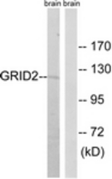 Western blot of extracts from mouse brain cells, using GRID2 Antibody. The lane on the right is treated with the synthesized peptide.