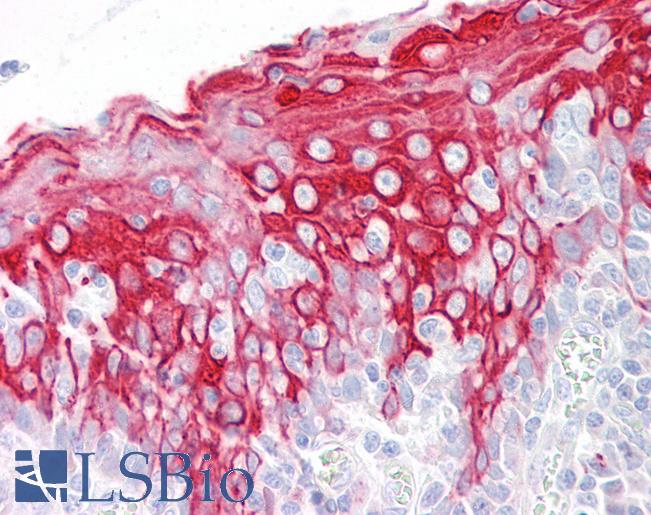 Anti-KRT16 / Cytokeratin 16 antibody IHC of human tonsil. Immunohistochemistry of formalin-fixed, paraffin-embedded tissue after heat-induced antigen retrieval. Antibody LS-B7609 concentration 10 ug/ml.