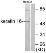Western blot of extracts from HepG2 cells, using Keratin 16 Antibody. The lane on the right is treated with the synthesized peptide.
