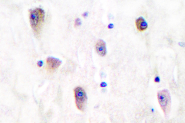 IHC of GluR5 (L12) pAb in paraffin-embedded human brain tissue.