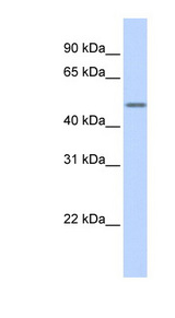 KRT16 / Cytokeratin 16 antibody LS-C101951 Western blot of Transfected 293T cell lysate.