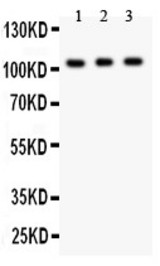 GRIK1 antibody Western blot. All lanes: Anti GRIK1 at 0.5 ug/ml. Lane 1: Mouse Brain Tissue Lysate at 50 ug. Lane 2: Mouse Brain Tissue Lysate at 50 ug. Lane 3: SHG Whole Cell Lysate at 40 ug. Predicted band size: 104 kD. Observed band size: 104 kD.