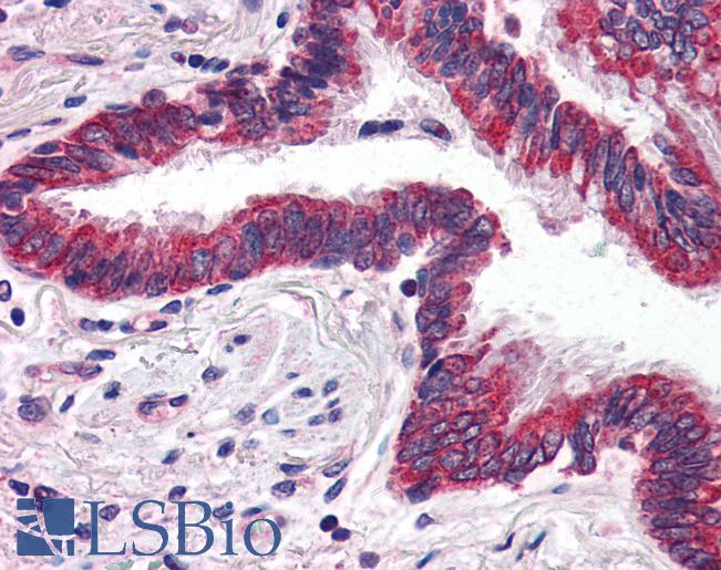 Anti-GRIK1 antibody IHC of human lung. Immunohistochemistry of formalin-fixed, paraffin-embedded tissue after heat-induced antigen retrieval. Antibody LS-B2691 concentration 5 ug/ml.