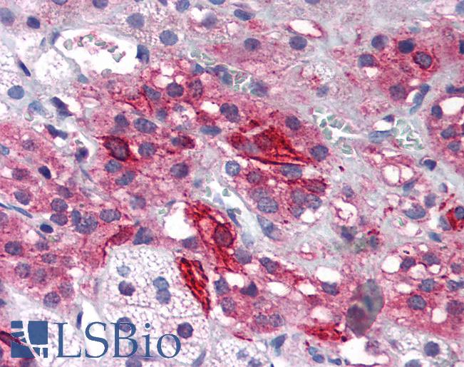 Anti-GRIK1 antibody IHC of human adrenal. Immunohistochemistry of formalin-fixed, paraffin-embedded tissue after heat-induced antigen retrieval. Antibody LS-B2692 concentration 5 ug/ml.