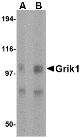 Western blot of Grik1 in rat brain tissue lysate with Grik1 antibody at (A) 0.5 and (B) 1 ug/ml.