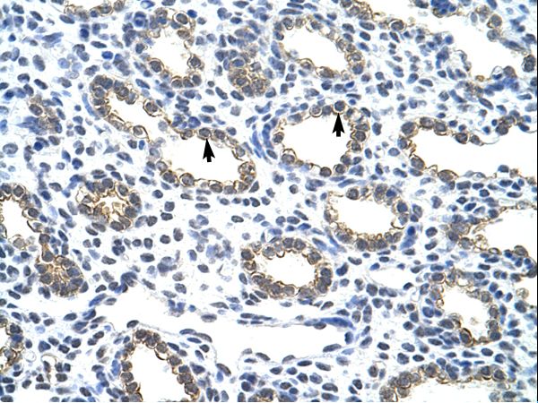 KRT18 / Cytokeratin 18 antibody LS-C31626 was used in IHC to stain formalin-fixed, paraffin-embedded human lung.