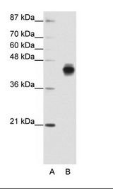 A: Marker, B: HepG2 Cell Lysate