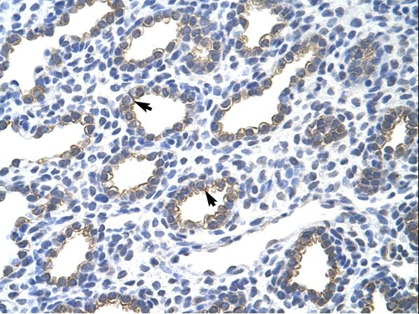 KRT18 / Cytokeratin 18 antibody LS-C31625 was used in IHC to stain formalin-fixed, paraffin-embedded human lung.