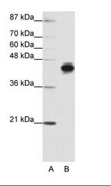 A: Marker, B: HepG2 Cell Lysate