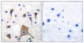 IHC of paraffin-embedded human brain tissue, using GluR5 Antibody. The picture on the right is treated with the synthesized peptide.
