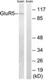 Western blot of extracts from mouse brain cells, using GluR5 Antibody. The lane on the right is treated with the synthesized peptide.