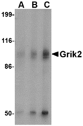 Western blot of Grik2 in human brain tissue lysate with Grik2 antibody at (A) 0.5 and (B) 1 ug/ml.