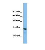Western blot of Human ACHN. GRIK2 antibody dilution 1.0 ug/ml.