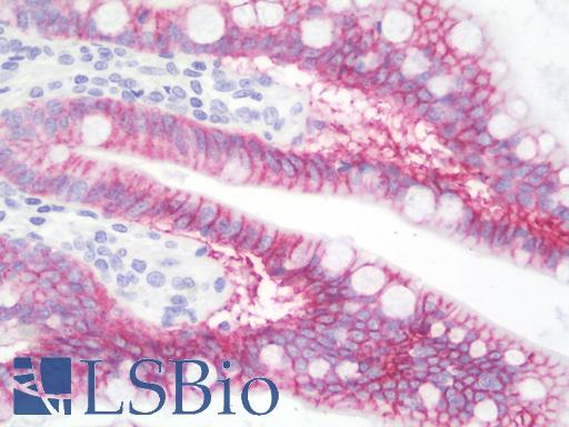 Anti-GRIK2 / GLUR6 antibody IHC staining of human small intestine. Immunohistochemistry of formalin-fixed, paraffin-embedded tissue after heat-induced antigen retrieval. Antibody LS-B9972 dilution 1:100.