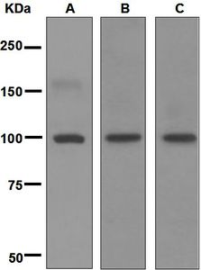 Western blot analysis on (A) fetal brain, (B) human kidney, and (C) A431 lysates using anti-GluR6 antibody.