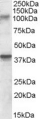 Antibody (0.3 ug/ml) staining of Rat Brain lysate (35 ug protein in RIPA buffer). Primary incubation was 1 hour. Detected by chemiluminescence