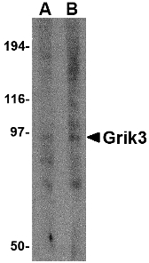 Western blot of Grik3 in human brain tissue lysate with Grik3 antibody at (A) 1 and (B) 2 ug/ml.