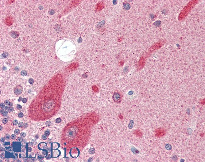 Anti-GRIK4 antibody IHC of human brain, cerebellum. Immunohistochemistry of formalin-fixed, paraffin-embedded tissue after heat-induced antigen retrieval. Antibody LS-B3215 concentration 5 ug/ml.
