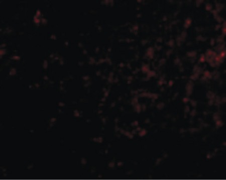 Immunofluorescence of Grik4 in Human Brain cells with Grik4 antibody at 20 ug/ml.