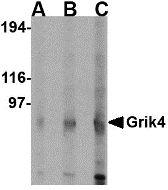Western blot of Grik4 in rat brain lysate with Grik4 antibody at (A) 0.5 (B) 1 and (C) 2 ug/ml.