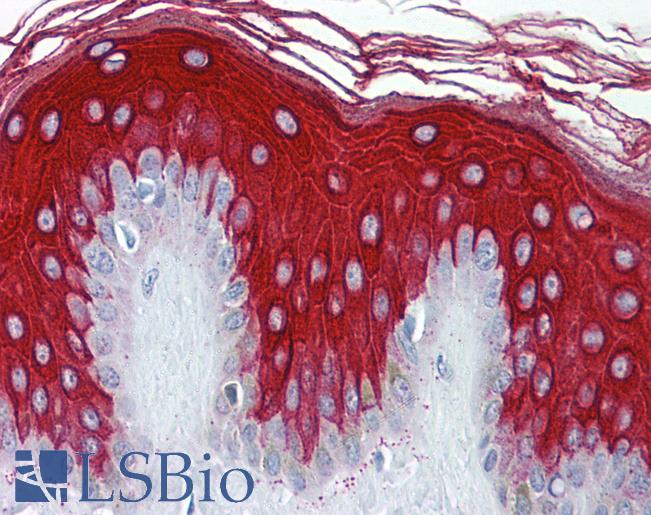 Anti-Cytokeratin 19 antibody IHC of human skin. Immunohistochemistry of formalin-fixed, paraffin-embedded tissue after heat-induced antigen retrieval. Antibody LS-B5801 concentration 5 ug/ml.