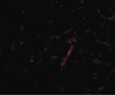 Immunofluorescence of Grik4 in Human Brain cells with Grik4 antibody at 20 ug/ml.